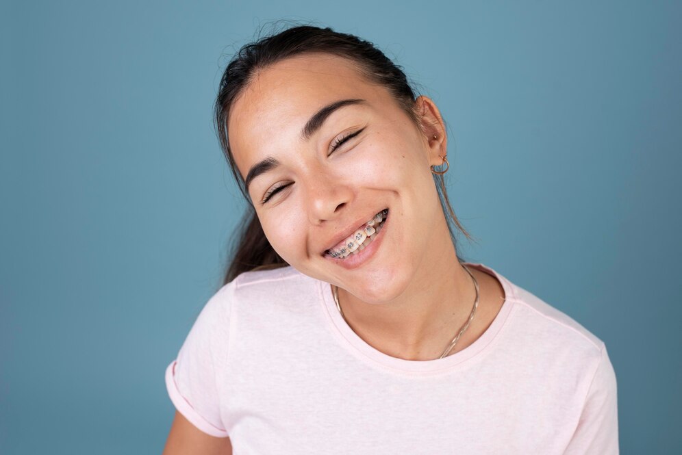 Smile Designing